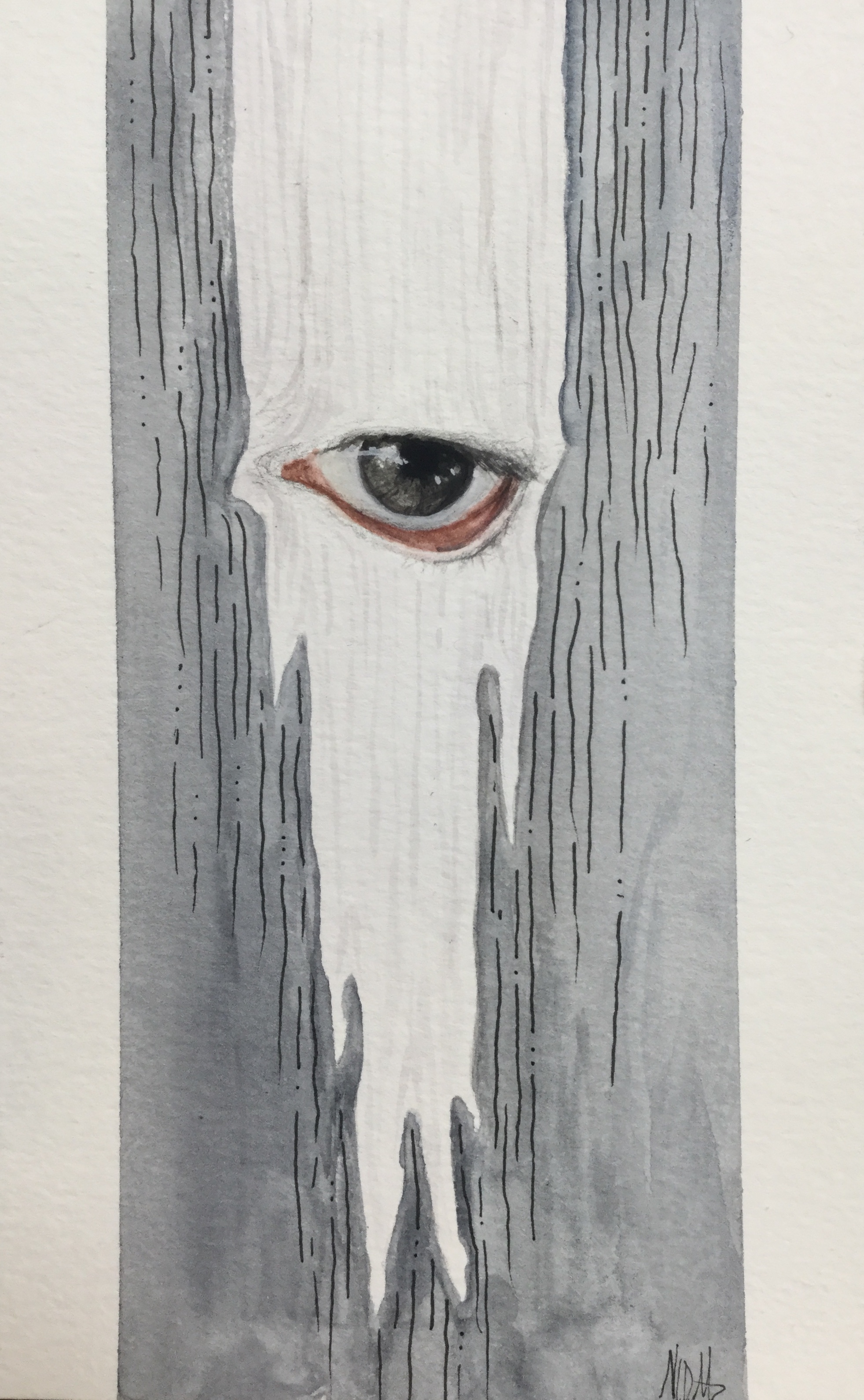 Watercolor painting of an eye with a saggy lower eyelid