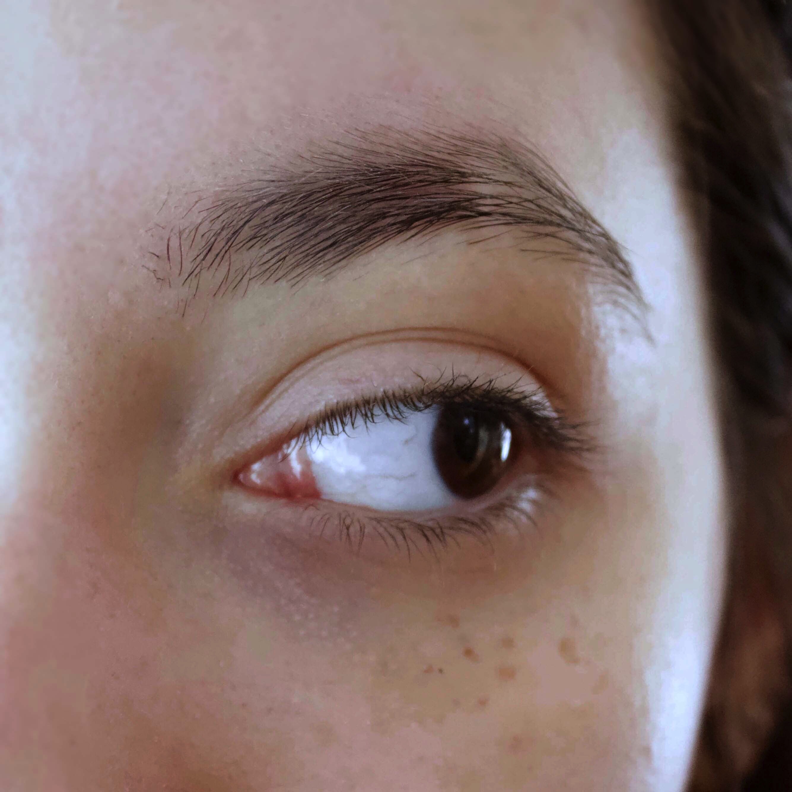 Photograph of an eye looking all the way to the right