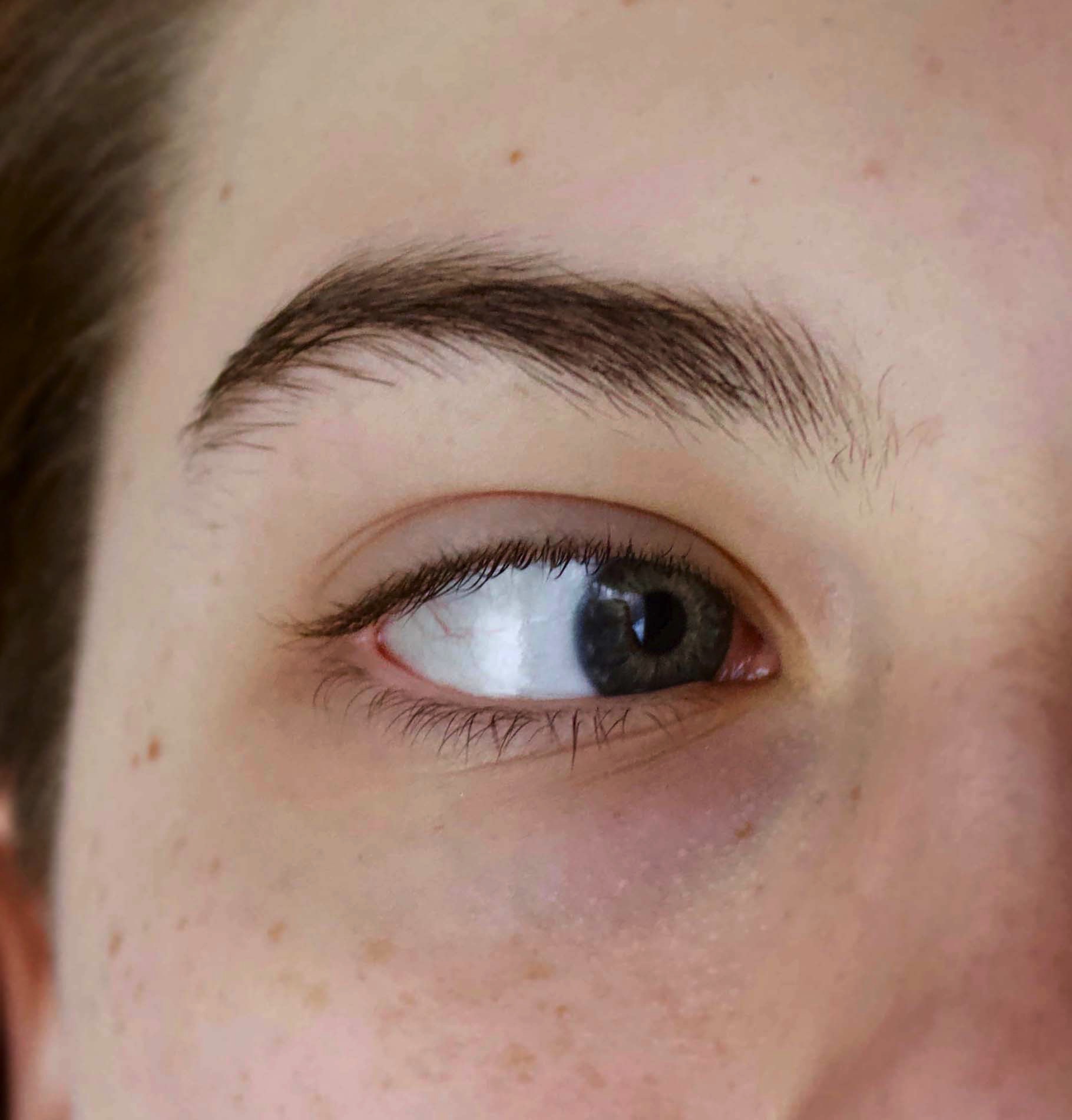 Photograph of an eye looking to the right